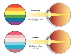 Can a colour blind person see any colours - Louie Eye Care
